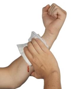 bleeding aid pressure wound pad apply dressing bandage bulky firmly firm sterile clean hand use over
