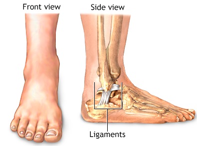 sprain aid ankle sprains type