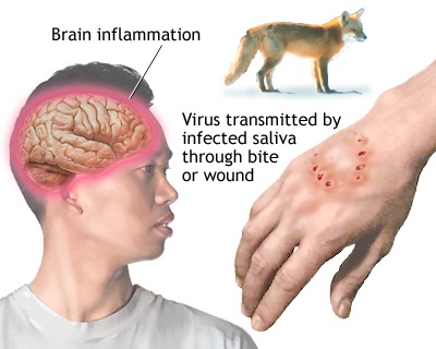 First Aid Animal Bites Health Safety Environment