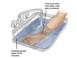 chemical burn first aid